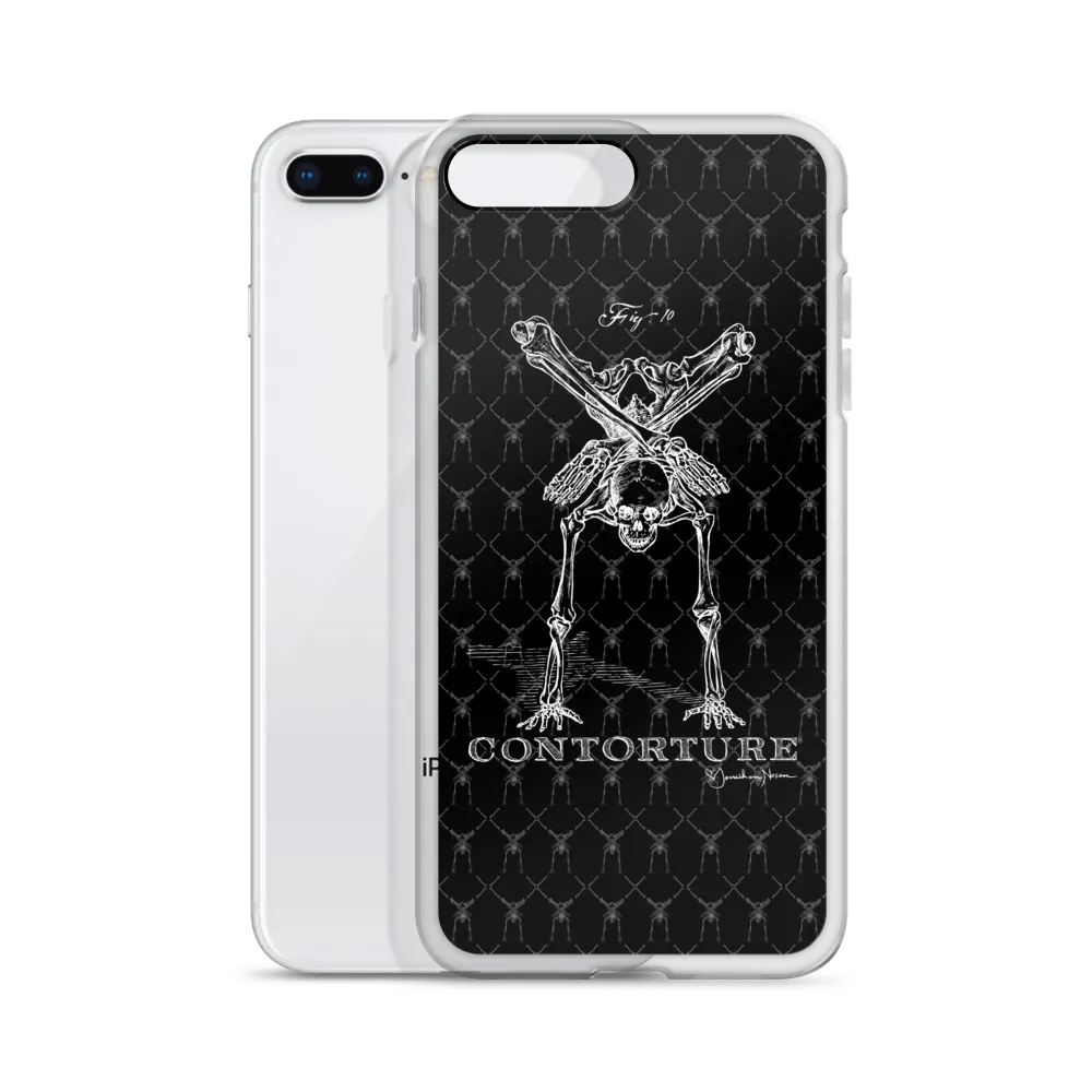 Contorture iPhone Case: Boney White Contortion Skeleton