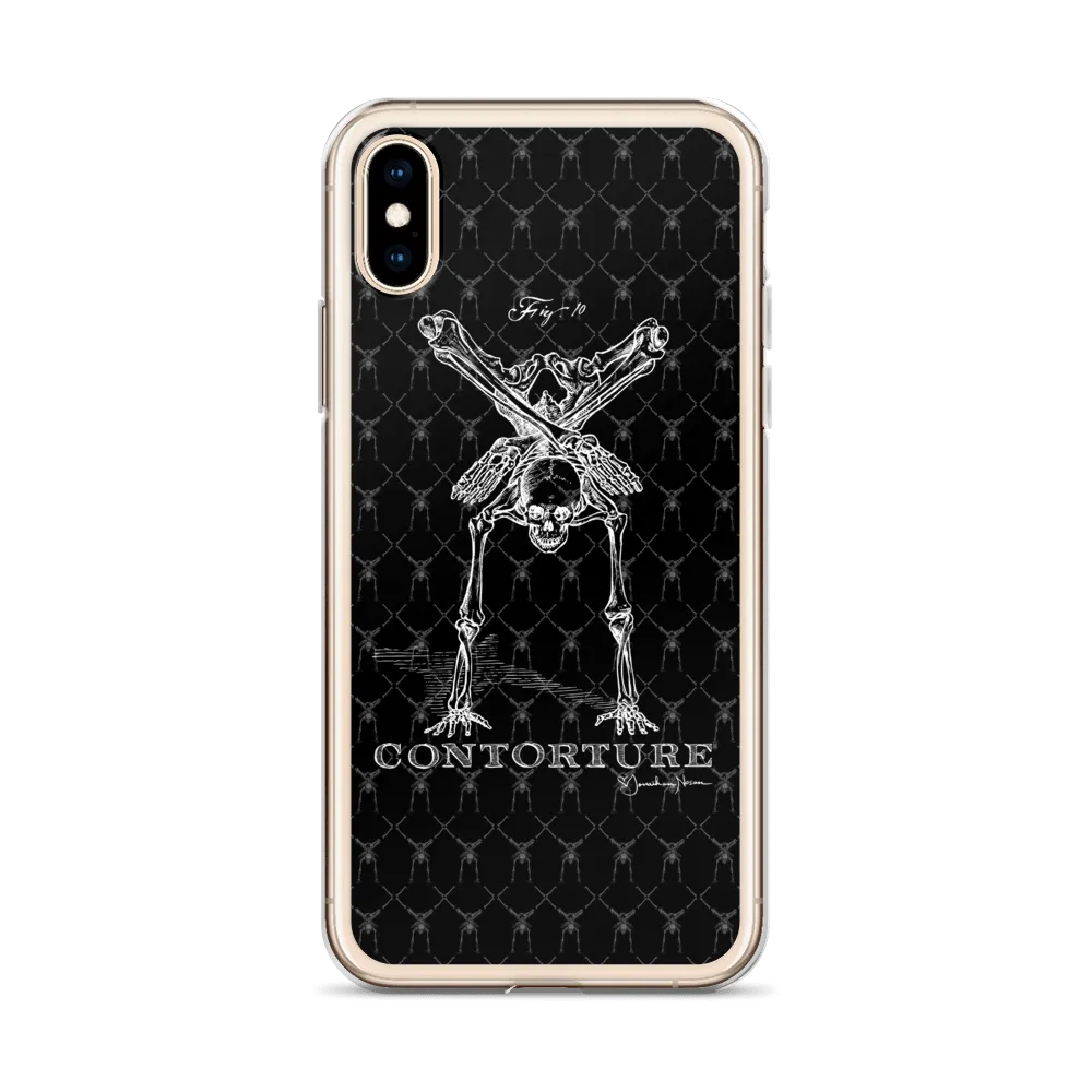 Contorture iPhone Case: Boney White Contortion Skeleton