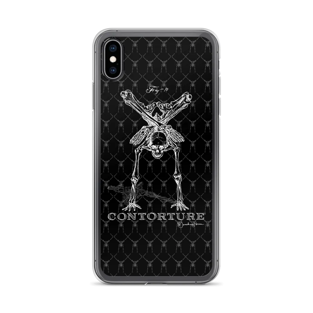 Contorture iPhone Case: Boney White Contortion Skeleton