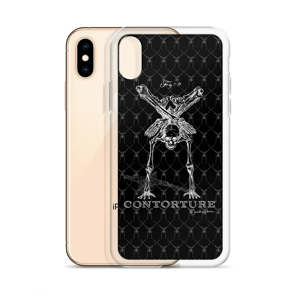 Contorture iPhone Case: Boney White Contortion Skeleton