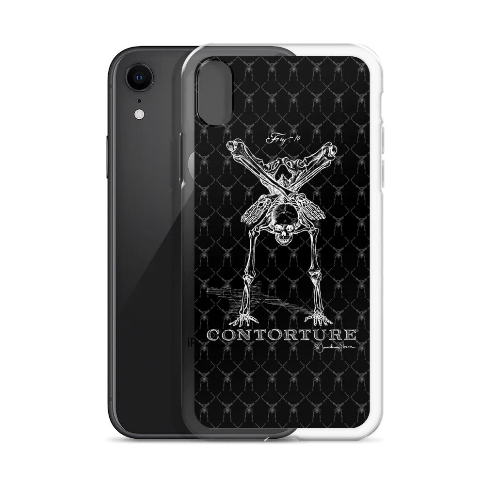 Contorture iPhone Case: Boney White Contortion Skeleton