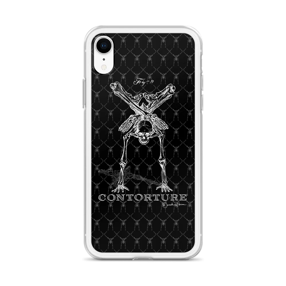 Contorture iPhone Case: Boney White Contortion Skeleton