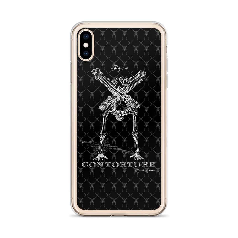 Contorture iPhone Case: Boney White Contortion Skeleton