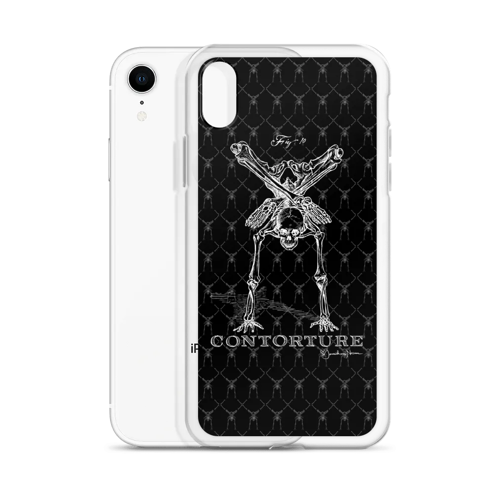 Contorture iPhone Case: Boney White Contortion Skeleton