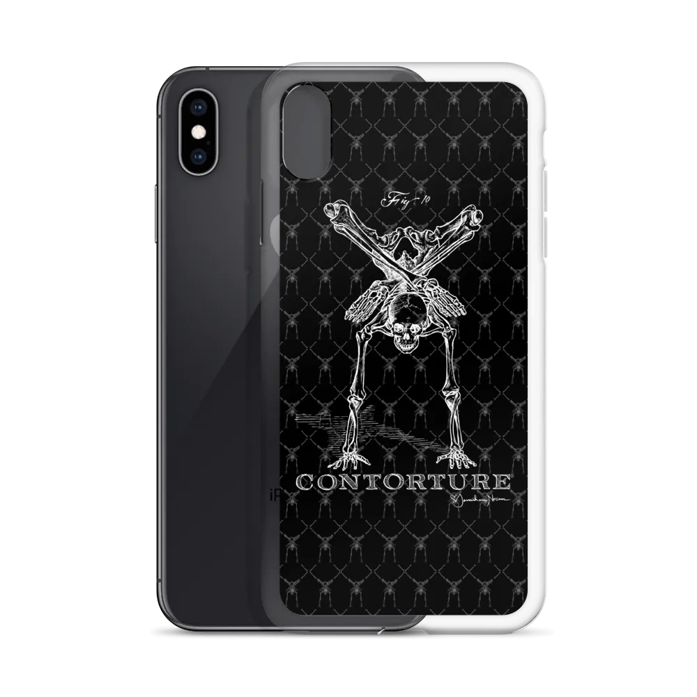 Contorture iPhone Case: Boney White Contortion Skeleton