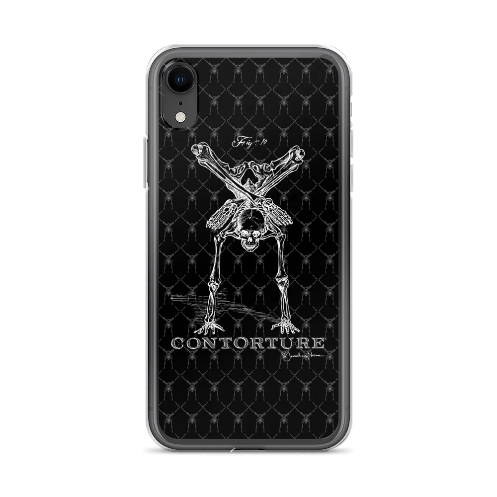 Contorture iPhone Case: Boney White Contortion Skeleton